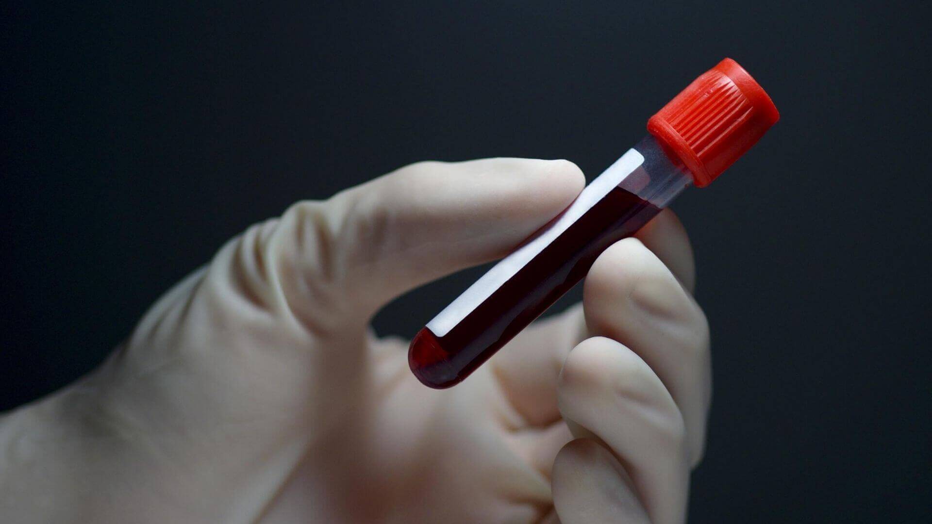 Phlebotomists - A Key Healthcare Professional