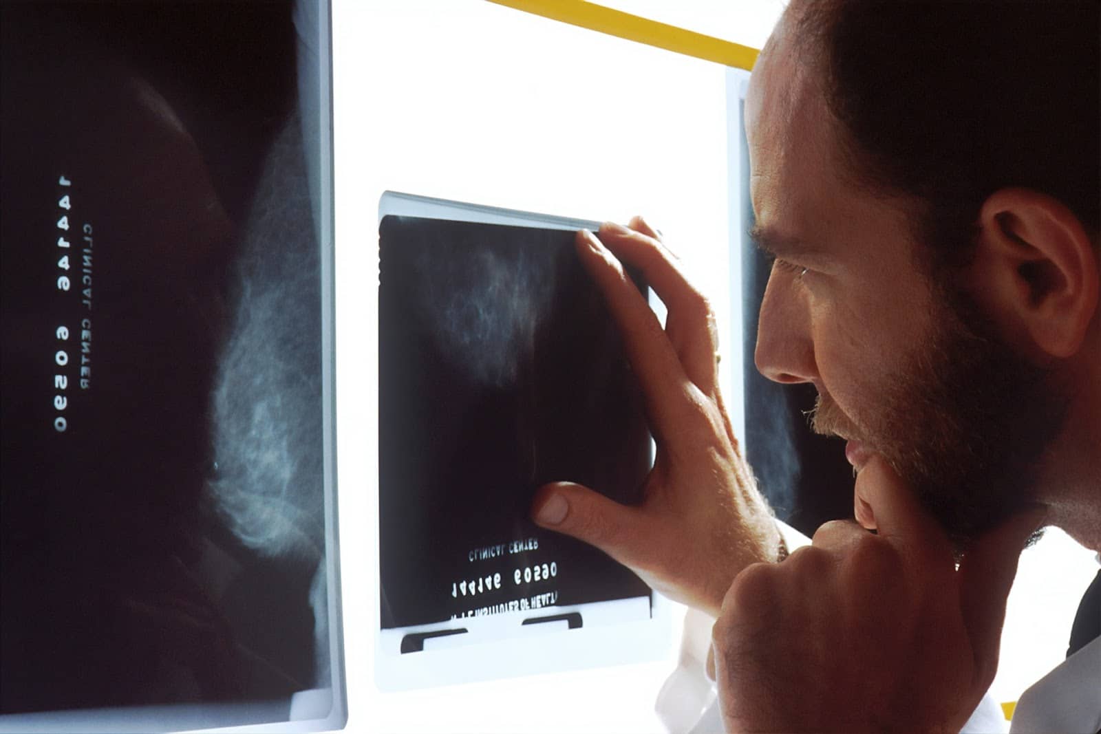 Male technologist reviews patient's medical image